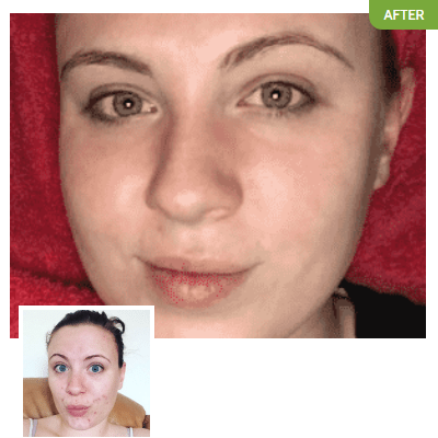 Exposed Skin Care - Kim Kilgour