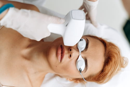 5 Reasons to Avoid Laser Genesis Acne Treatment