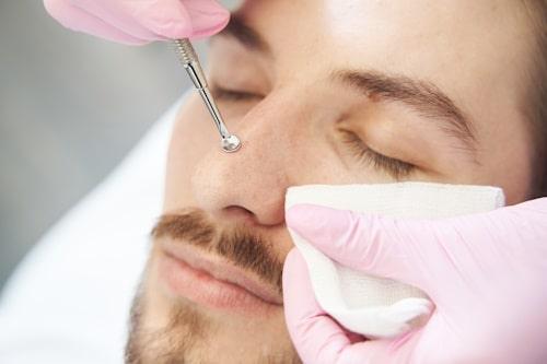 Proper Way to Use Acne Tool: Clear Skin Secrets!