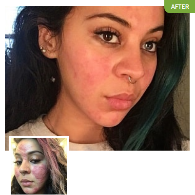 Exposed Skin Care - Elisa Ramirez