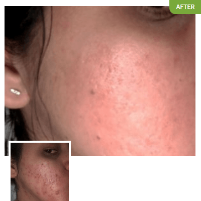 Exposed Skin Care - J. Stone