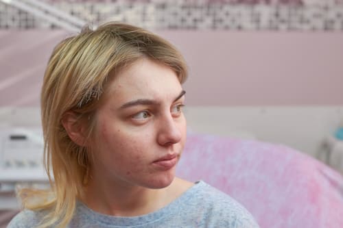 What Is Allergic Reaction Acne? (Causes, Treatments, and More)