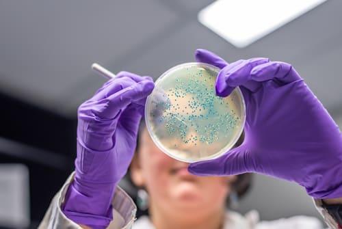How Does Propionibacterium Acnes Cause Acne in Humans? (Causes, Treatments, And  More)