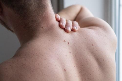 Cystic Acne on Back of Neck (Causes, Treatments, and More)