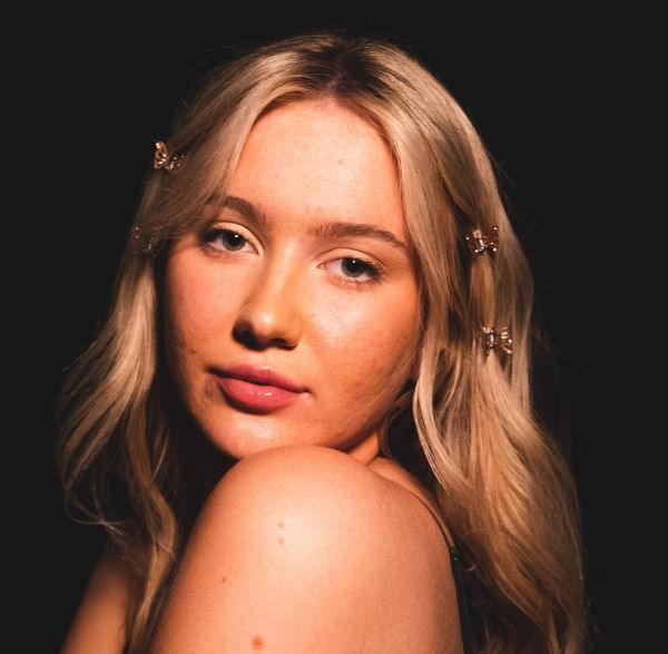 What To Do When Jawline Acne Won’t Go Away