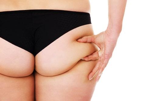 How To Get Rid Of Butt Acne Fast (This One’s From Exposed)
