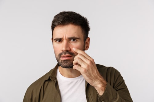 Picture of man worried about acne above beard