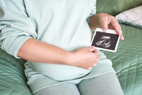 Is Acne in Pregnancy a Sign of a Girl? (Short Answer: No)