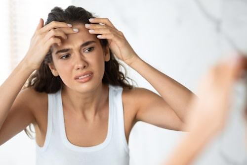 How to Get Rid of Fungal Acne on Forehead (Tips, Tricks, and More)