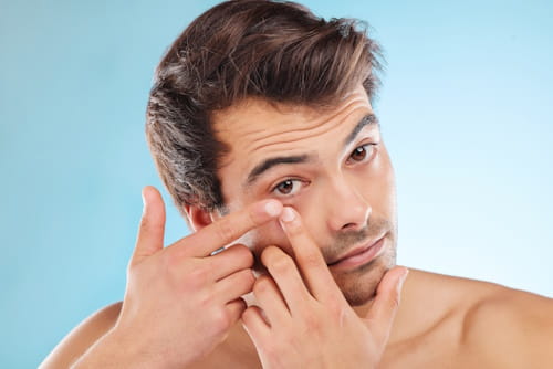 How to Balance Male Hormones for Acne (Everything You Need to Know)