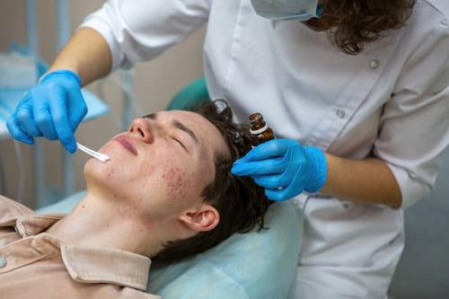 Chemical Peel For Acne Scars (Prep Right With Exposed)