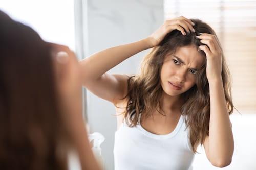 Can Dandruff Cause Acne? (Only Without Exposed)