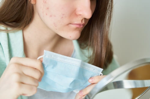 Cloth Mask vs Surgical Mask: Acne Causes