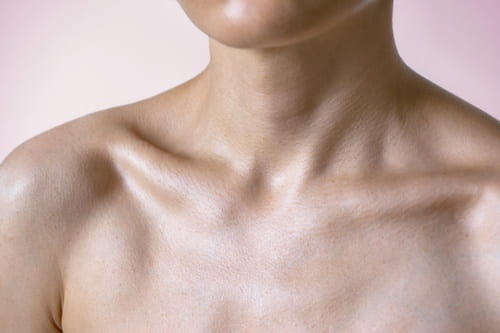 Acne on Neck and Chest (Causes, Treatments, and More)