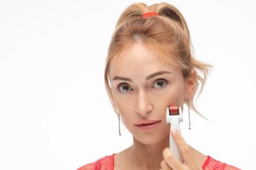 Are You Getting Acne After Microneedling? (Acne Causes, Treatments, and More)