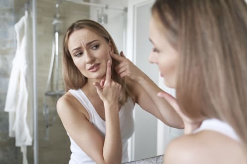 3 Best Hormonal Acne Treatments for Women
