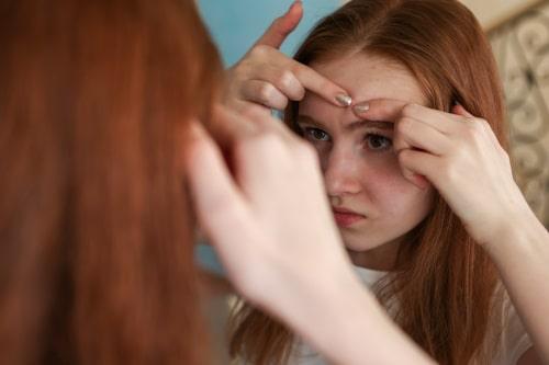 Why Do Teens Get Acne? (Exposed Actually Clears It Up)