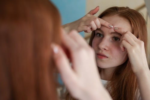 10 Signs of Acne You Shouldn’t Ignore