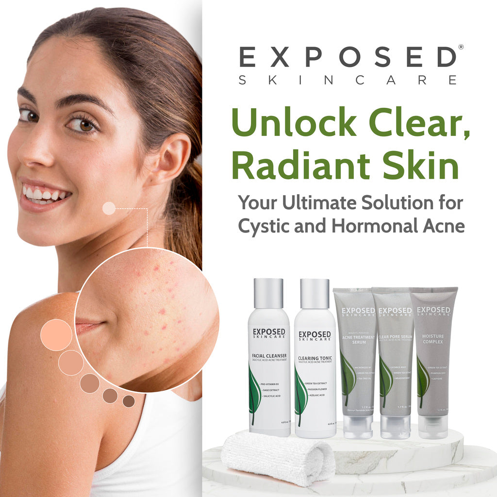 CLEAR Acne Treatment  Hawaiian Healing Skin Care